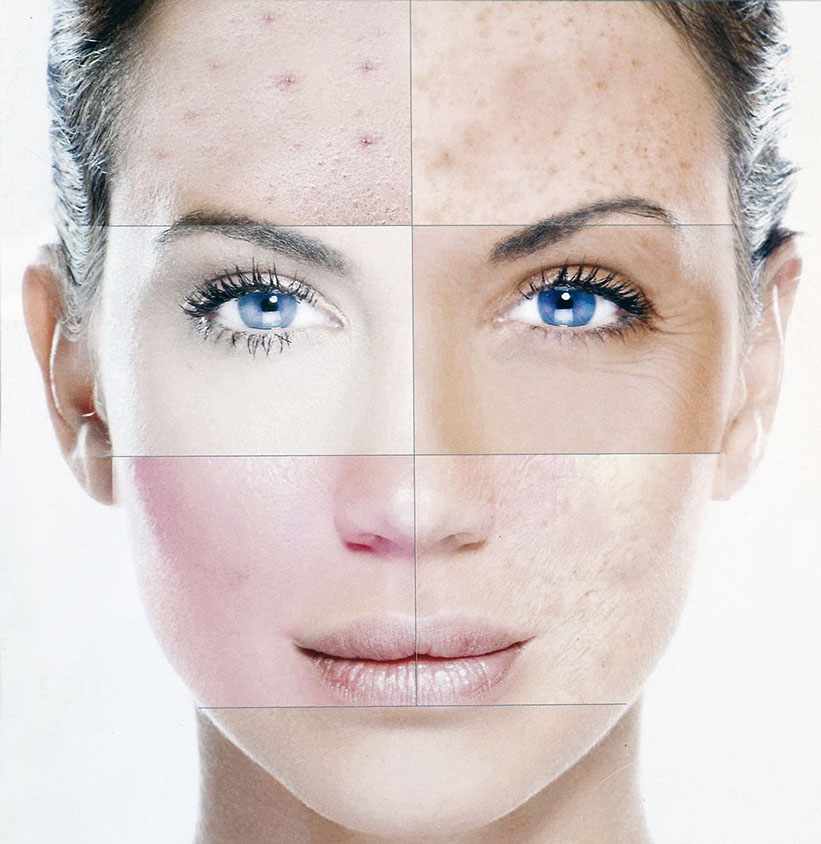 Как правильно определить тип кожи лица?